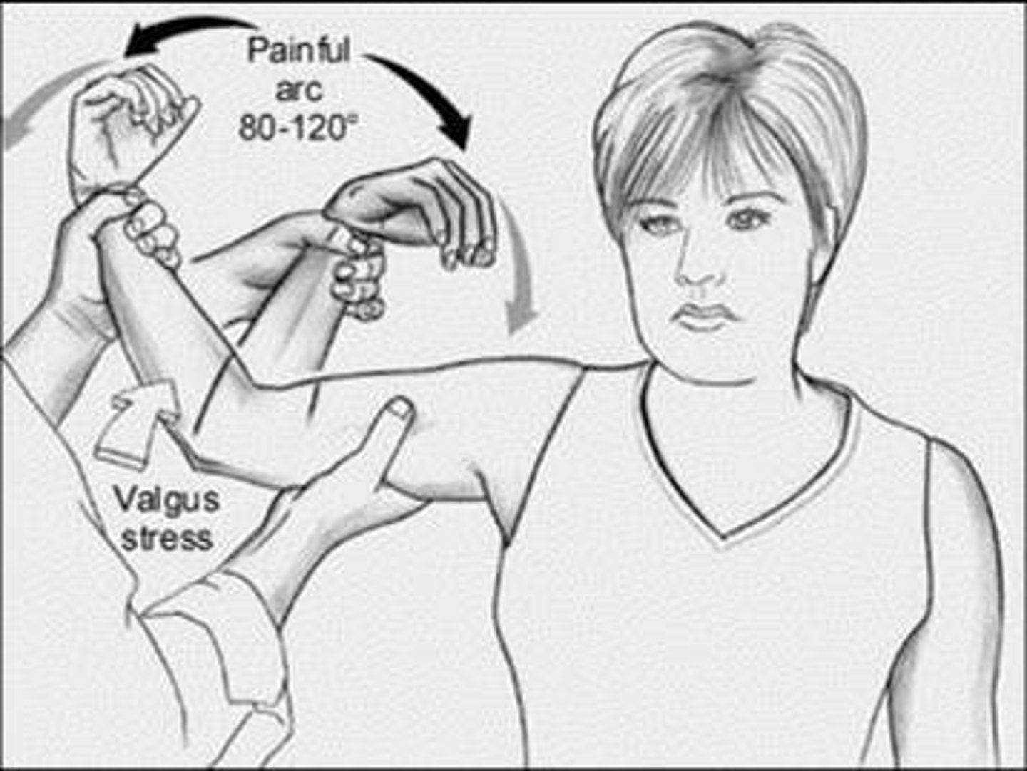 <p>move elbow from flexion to extension (30 deg)</p><p>elbow pain should increase within arc of 120 and 70 deg of flexion if +</p>