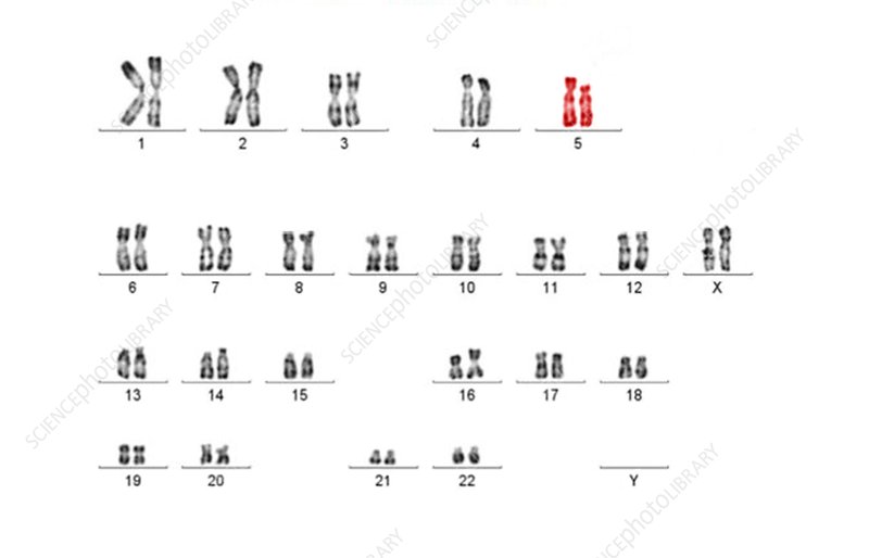 <p>Cri du chat syndrome mutation:</p>