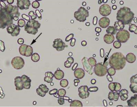 <p>Name the crystal</p>