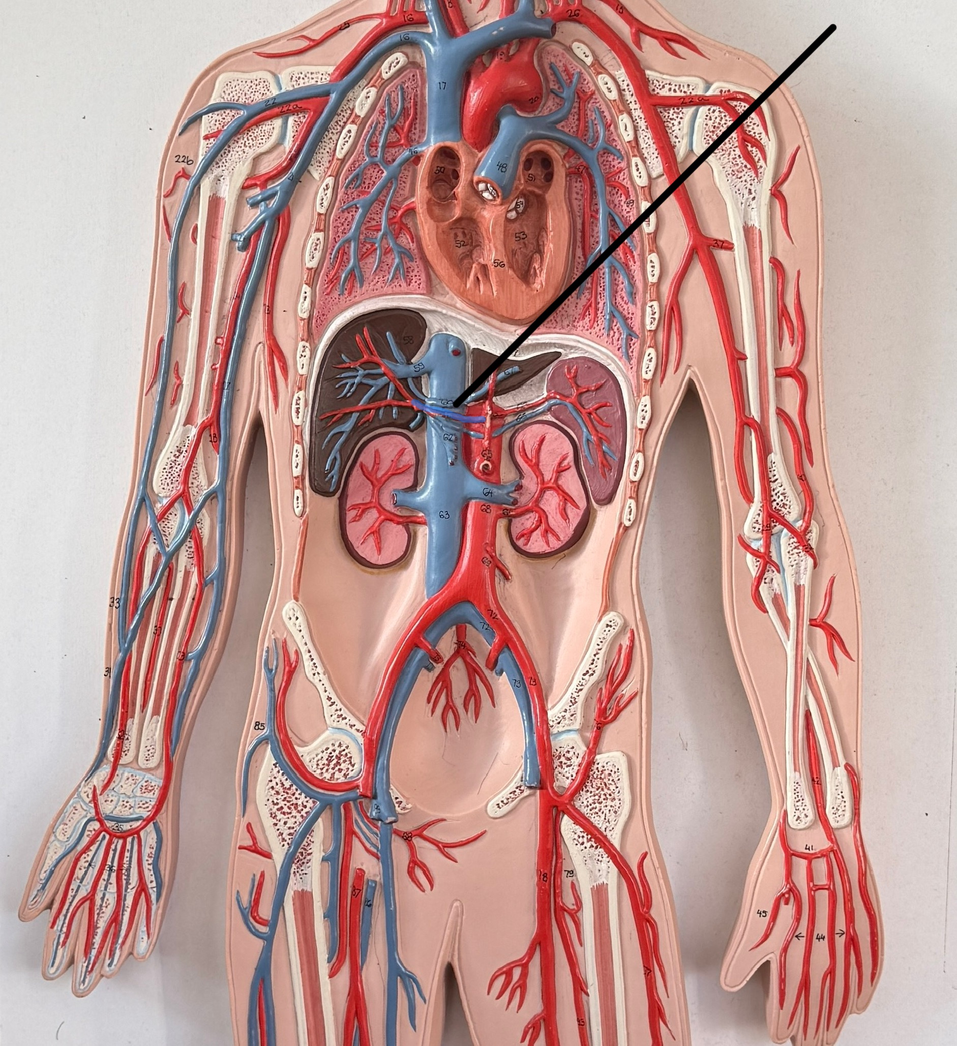 <p>Which artery is this?</p>