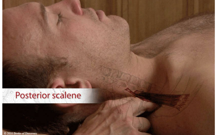 <p>Posterior scalene</p>