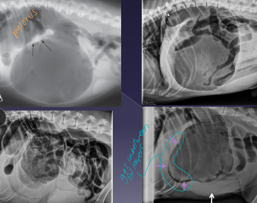 <ul><li><p><span style="color: rgb(136, 136, 136);"><strong>Et:</strong></span><strong> <u>pylorus moves R → ventral → L → dorsal</u></strong></p><ul><li><p>mucosal damage, sepsis, portal vein obx + hypertension, vena cava obx, poor cardiac output</p></li></ul></li></ul><ul><li><p><span style="color: rgb(136, 136, 136);"><strong>Sig: </strong></span><strong><u>Deep-chested</u>, Lg breeds</strong>, older, once-daily feeding, genetics, stress, exercise after eating</p></li></ul><ul><li><p><span style="color: rgb(136, 136, 136);"><strong>Cs:</strong></span><strong> Retching, pain, distended abdomen, hypersalivation, VPC, shock, <u>splenic congestion (often corrects on its own),</u> hypoxia, acidosis, death</strong></p></li></ul><ul><li><p><span style="color: rgb(136, 136, 136);"><strong>Dt: </strong></span><u>lactate trends,</u><span style="color: red;"><u> </u><strong><u>ECG (VPC),</u></strong></span> PT/PTT, <strong><u>RL rads</u></strong> w/ <u>double bubble</u></p></li><li><p><span style="color: rgb(136, 136, 136);"><strong>Tx: </strong></span>gastric decompress (Trocarization, OG tube), <span style="color: red;"><strong><u>right gastropexy,</u></strong></span> <strong><u>de-rotation,</u></strong> tube feed, famotidine, pantoprazole, mu opioids, fluids, O2</p><ul><li><p><strong><u>** Stand on left side, R hand pylorus, L hand on top of fundu</u></strong>s - then rotate **</p><ul><li><p><strong><u>Tx arrythmias if: V tach &gt;160-180. R on T, multifocal, pulse deficits</u></strong></p></li><li><p>Emergency but good prognosis&nbsp;&nbsp;</p></li><li><p><strong><u>NO NSAIDS or medical management</u></strong></p></li></ul></li></ul></li></ul><p></p>