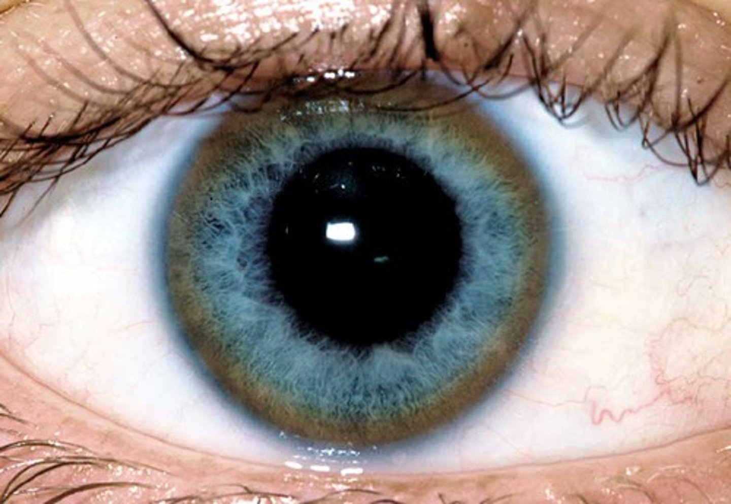 <p>golden-brown bands in the limbus of the cornea seen on slit lamp exam (due to copper deposition)</p>