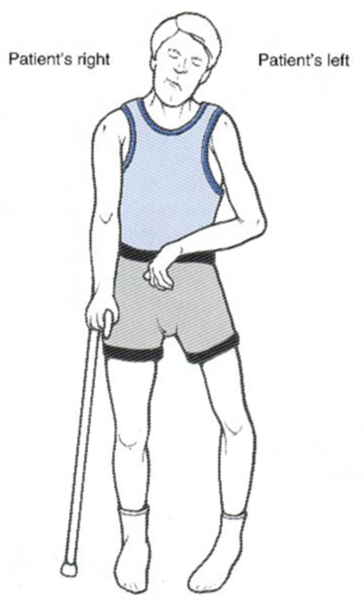 <p>(adj): Partial or total paralysis of one side of the body that results from disease of or injury to the brain.</p>