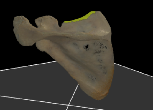 <p>de bovenste rand van de scapula</p>