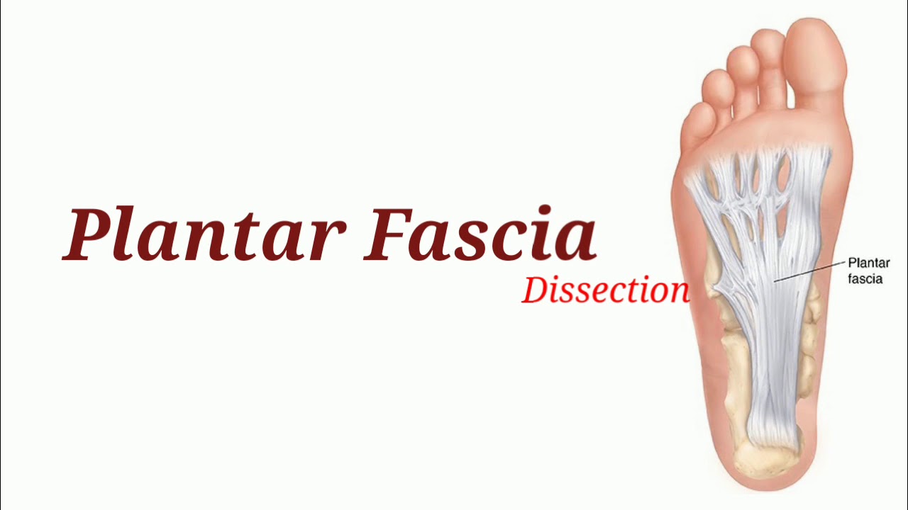 <p>Thick connective tissue band along the sole of the foot; supports the arch; easily palpable on the sole.</p>
