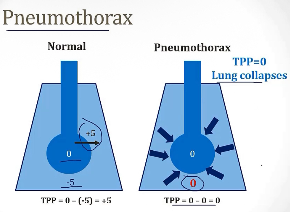 <p>-pressure in the pleural space</p><p>-negative</p><p>-collapse; expand; negative</p>
