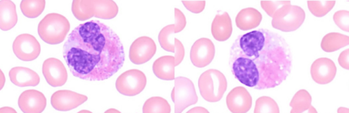 <p>completely filled with granules, specifically large, eosin-staining crystalloid granules that are uniform in size and evenly distributed.</p>