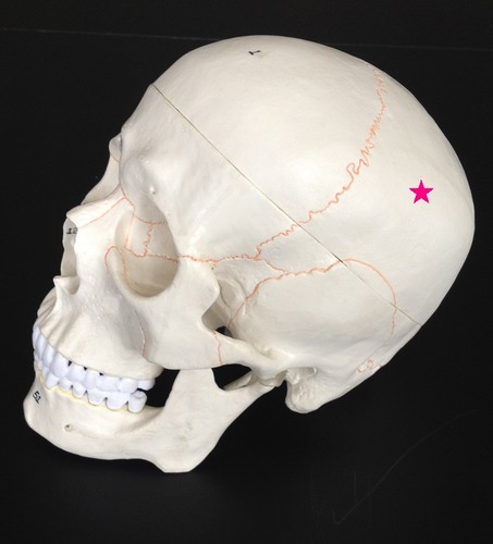 <p>Identify the bone.</p>