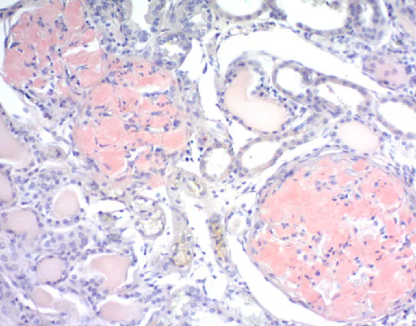 <p>- Congo red stain which highlights amyloid as pink/red</p><p>- Collagen</p>