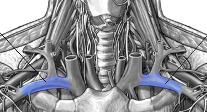<p>Which veins:</p><ul><li><p>Extends laterally from brachiocephalic vein</p></li><li><p>Inferior to internal jugular vein</p></li><li><p>Superior &amp; medial to axillary vein</p></li></ul><p></p>