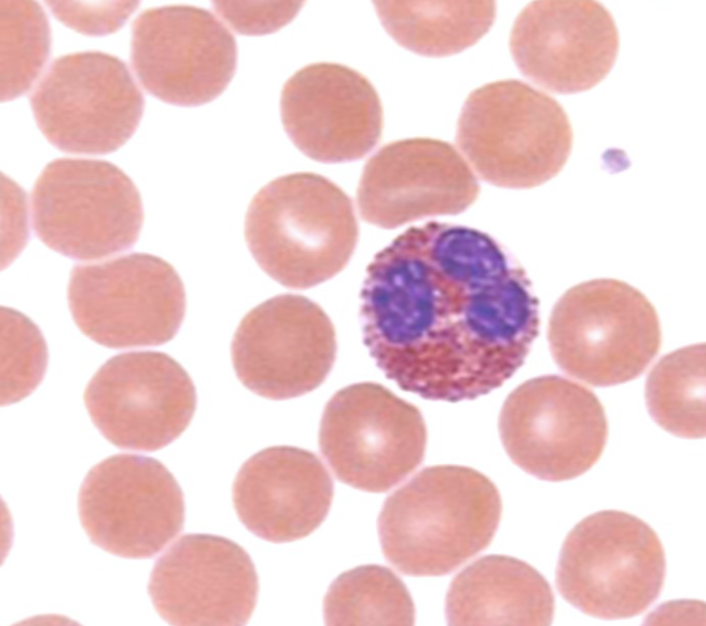 <p>what WBC is this?</p>