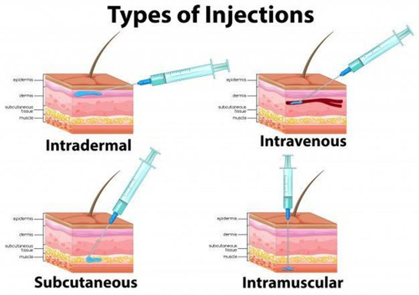 <p>Drug introduced directly into systemic circulation.</p>