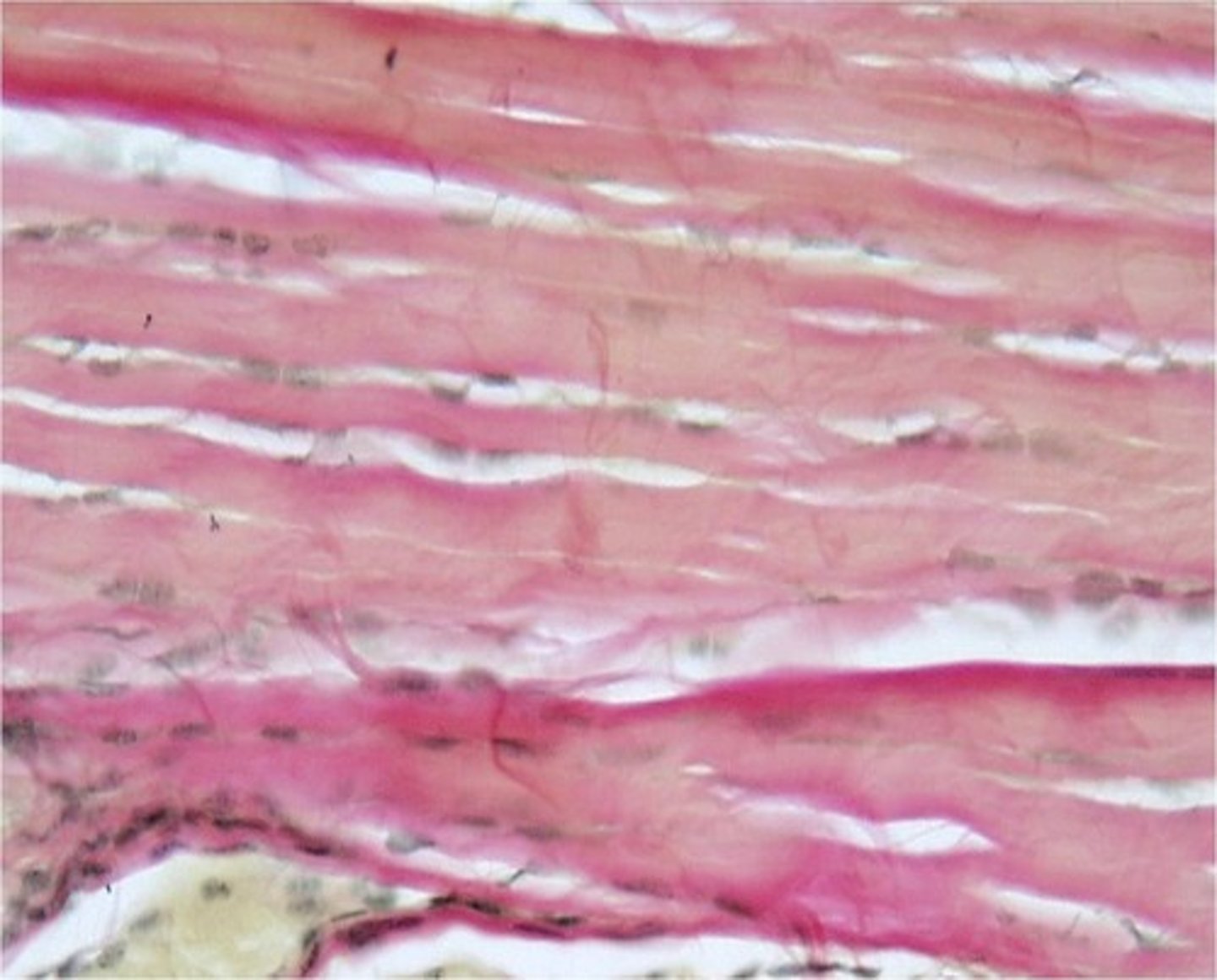 <p>-has mostly collagenous fibers, but are in a regular, parallel alignment</p><p>-provides tensile strength</p><p>-tendons and ligaments</p>