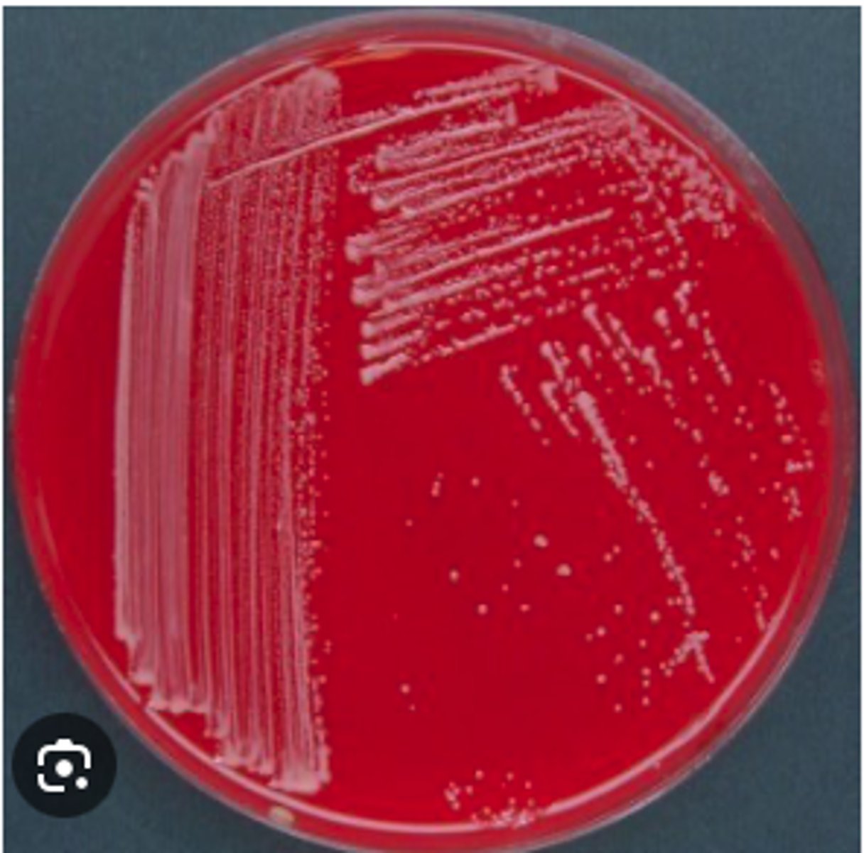 <p>An organism was isolated from a transtracheal fluid collected from a 2 month old foal with fever, lethargy and cough. A thoracic ultrasound revealed multiple, large lung lesions. You are provided with a 48 hr BA plate. There was no growth on MacConkey agar. A Gram stain of a smear prepared from the fluid revealed intracellular and extracellular gram-positive coccobacilli.</p><p>Is hemolysis present?</p>