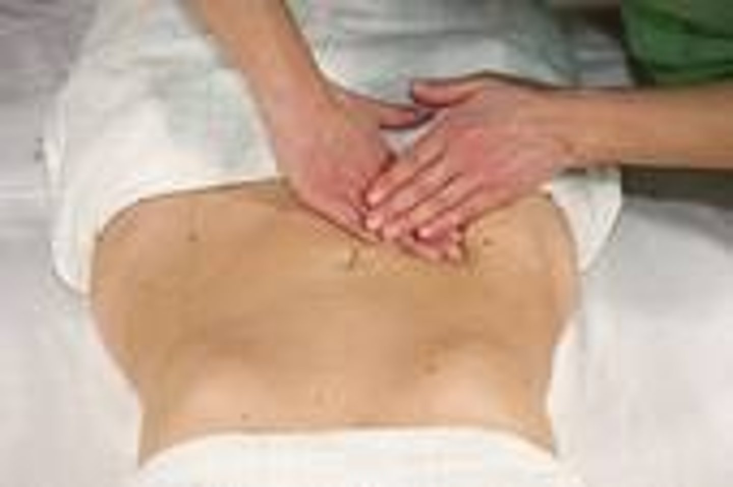 <p>Wanneer een lower spinal lesion optreedt thv S2-S4 valt de reflexmictie weg, alsook de PS innervatie van de blaas (contractie) en controle van de urethra (n. pudendus). Hierdoor moet de patiënt persen en via verhoogde abdominale druk de blaas leegplassen. We kunnen hierbij de pt helpen door het uitvoeren van de handgreep van ....?</p>