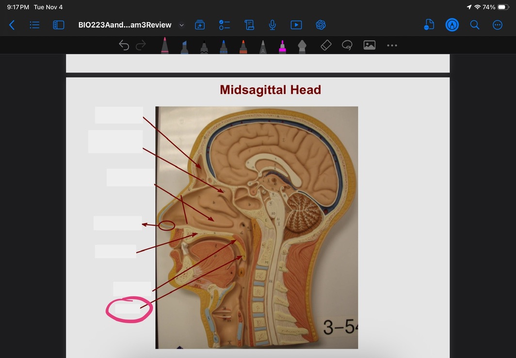 <p>What is this?</p>