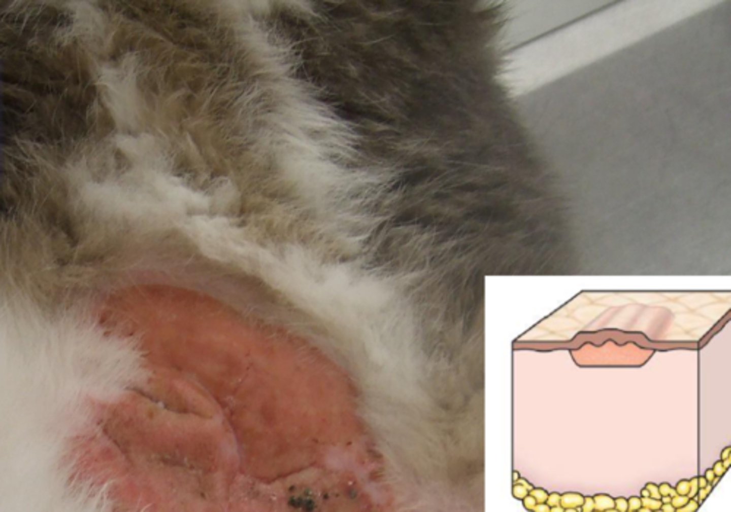 <p>What lesion is this? Is it primary or secondary?</p>