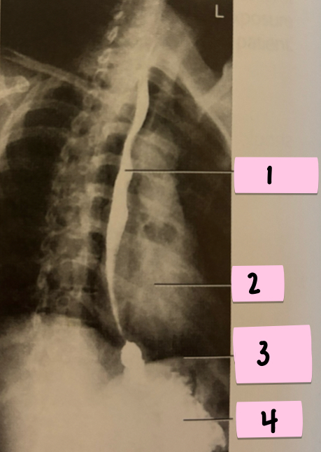 <p>What is 3 pointing to?</p>