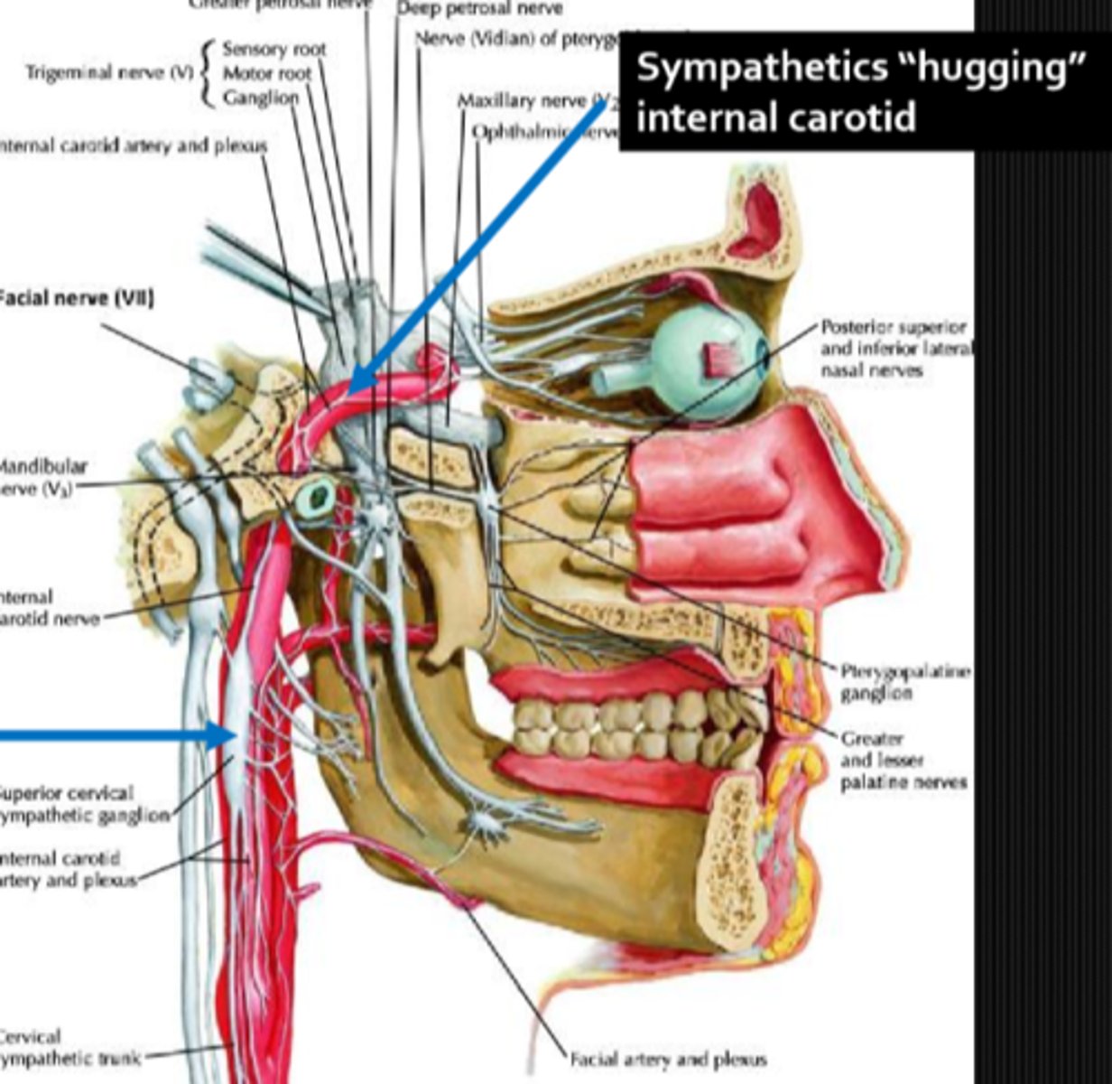 <p>symp fibers that are very close to the ICA = lesions here </p>
