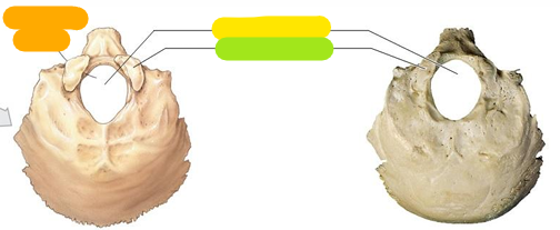 <p>Yellow</p>