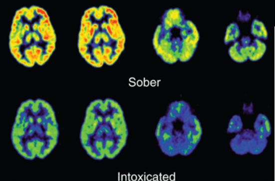 <p>reduces brain metabolism</p>