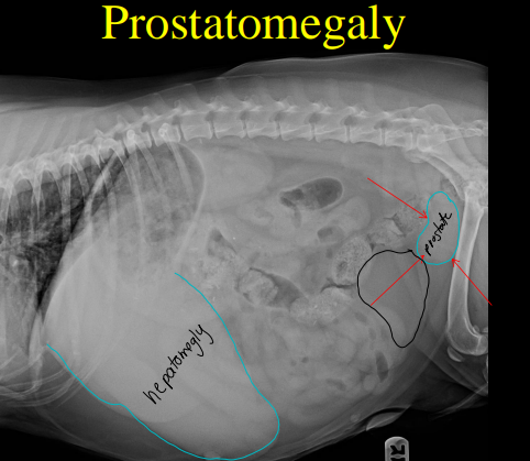 <p>Prostate disease  on Radiographs </p>