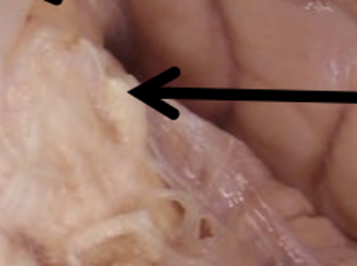 <p>5: sensation to face, mastication</p><p>6: abducens, eye movement</p>