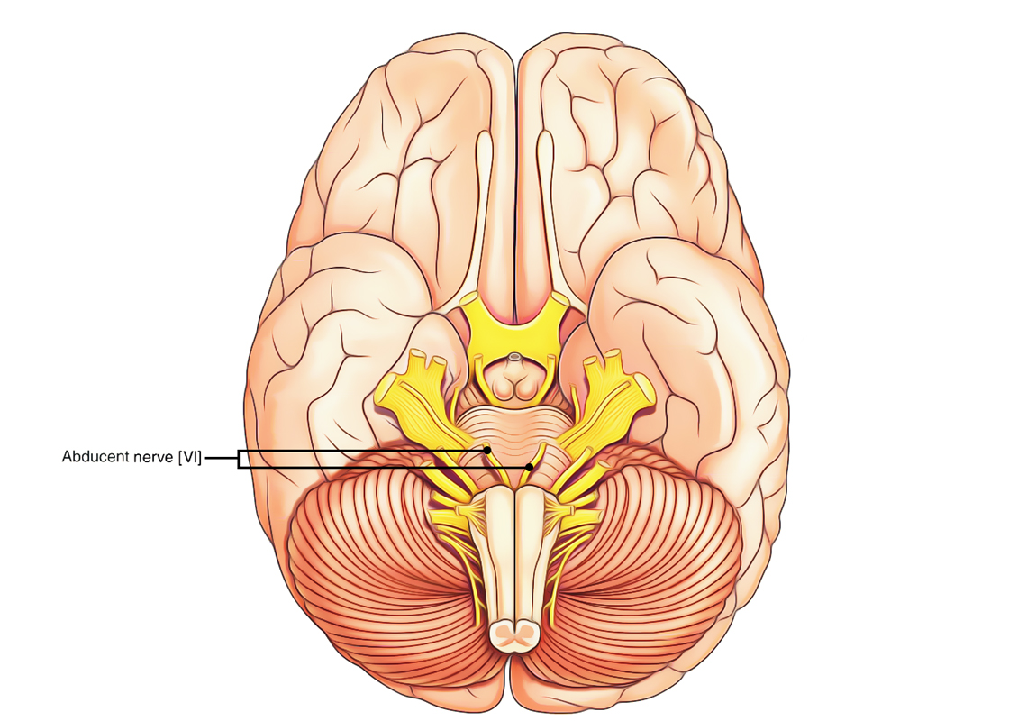 <p>abducens (VI)</p>