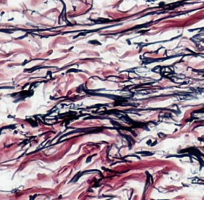 <p>Identify this connective tissue, its location, and its function.</p>