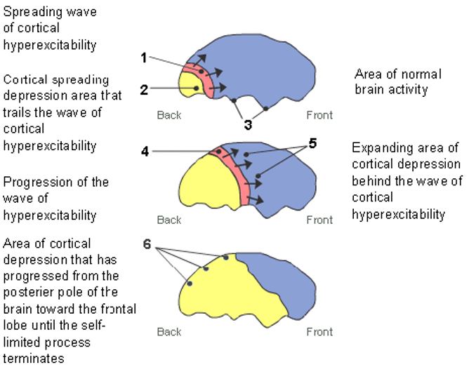 aura/cortical spreading depression