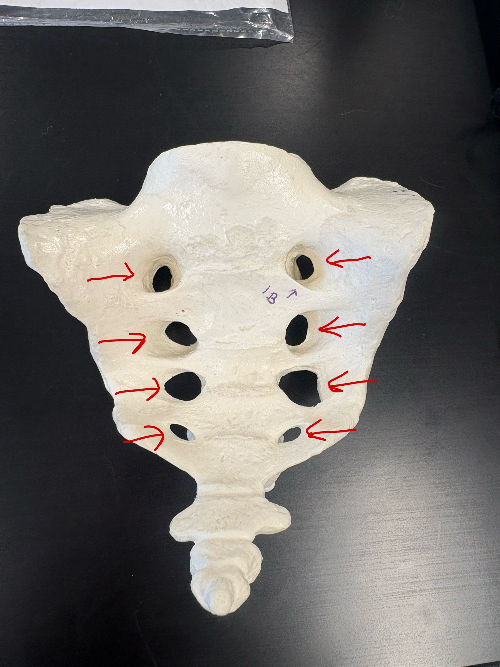 <p>Name this structure</p>