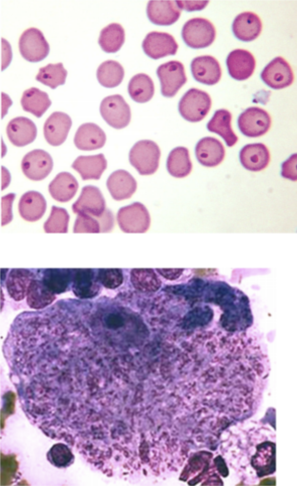 <p>How is feline cytauxzoonosis diagnosed?</p>