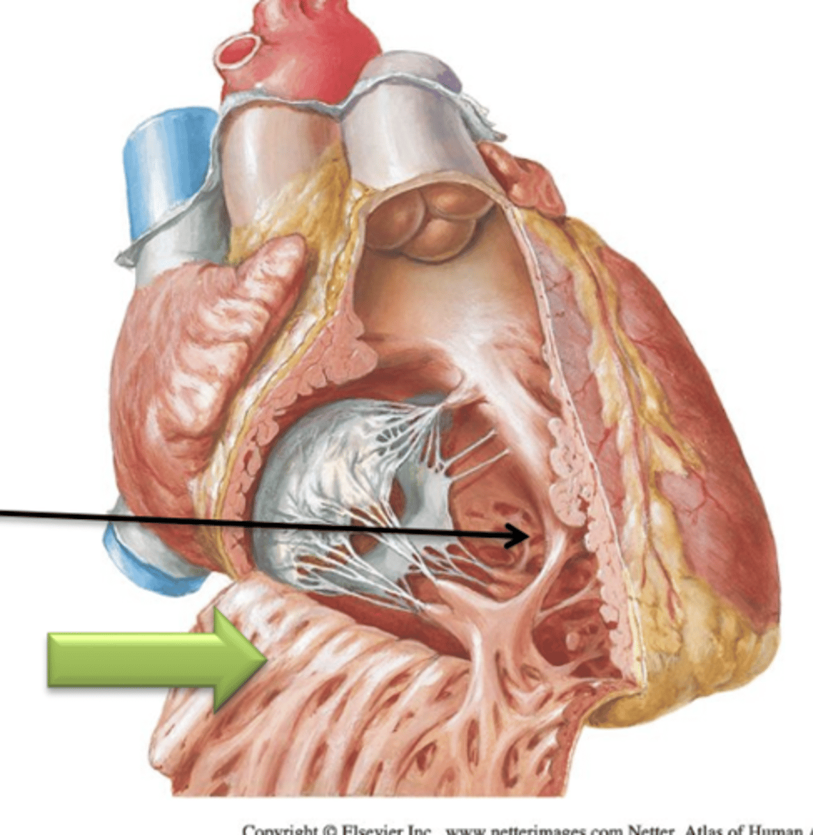 <p>Another type of trabeculae carneae that is a band of tissue that attaches the interventricular septum to the papillary muscle. It contains important nerve fibers of the conduction system of the heart.</p>