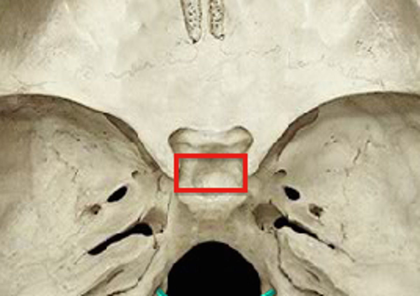 <p>Sphenoid</p>