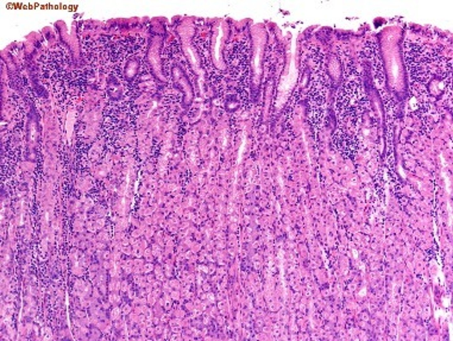 <p>shallow pits with straight glands</p>