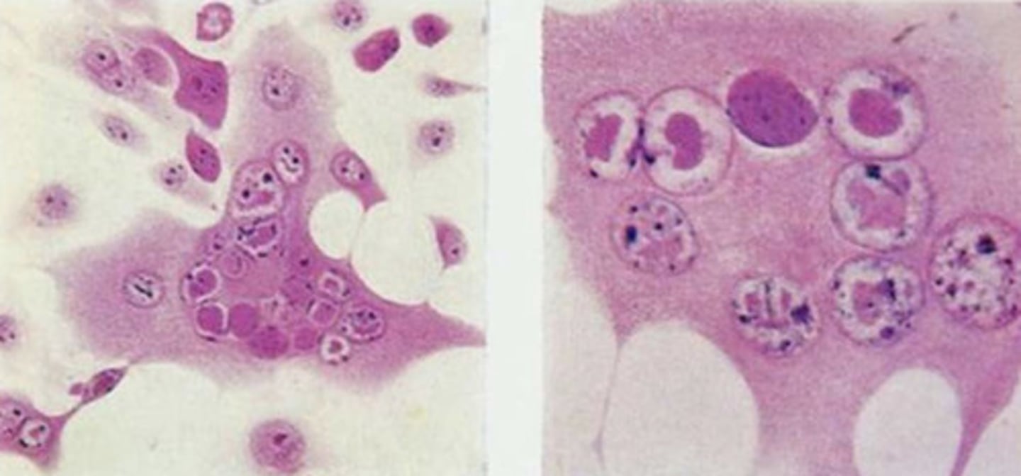 <p>what are these on a histopathology that you took from a dog diagnosed with Canine Herpesvirus</p>