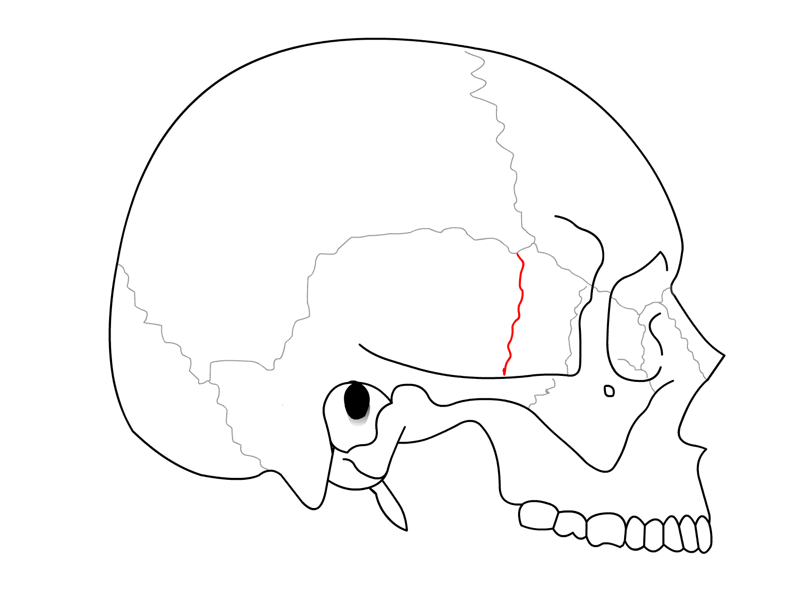 <p>sphenotemporal suture (lateral view)</p>