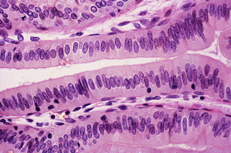 <p>Subcategories of Epithelium: Shape - Columnar</p>