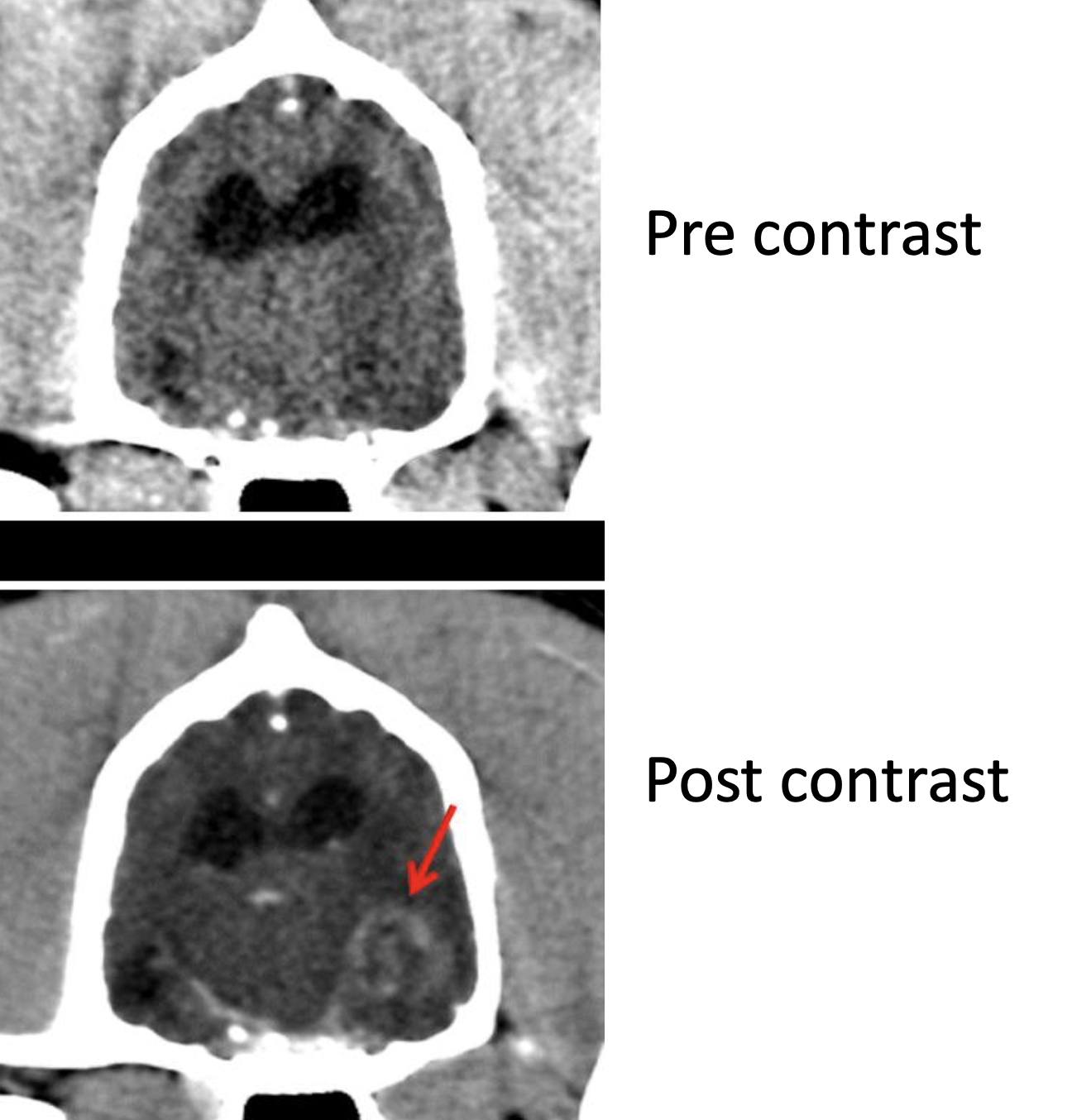 <ul><li><p>Soft tissue</p></li><li><p>nhance contrast of soft tissues</p></li></ul><p></p>