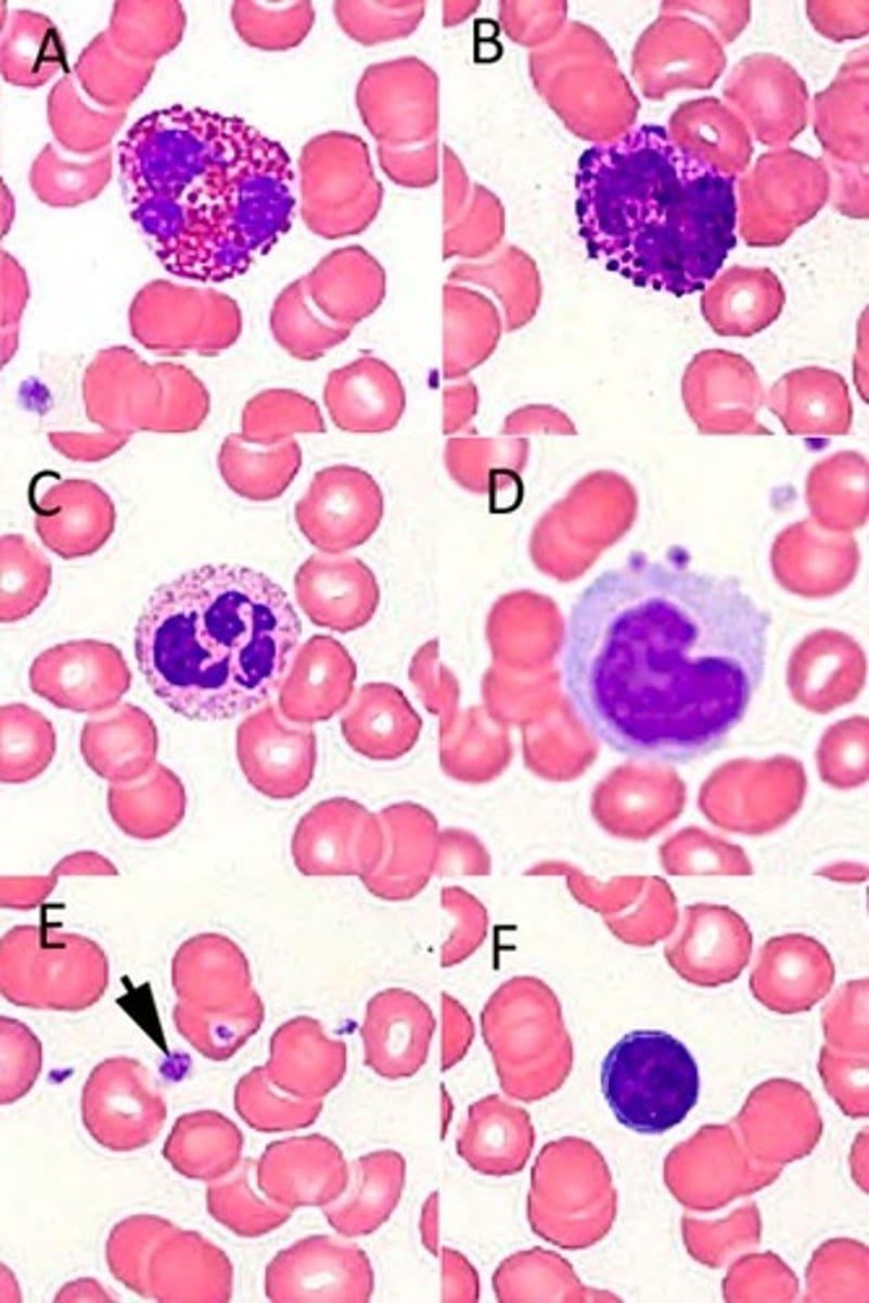 <p>A: Eosinophil</p><p>B: Basophil</p><p>C: Neutrophil</p><p>D: Monocyte</p><p>E: Platelet</p><p>F: Lymphocyte</p>