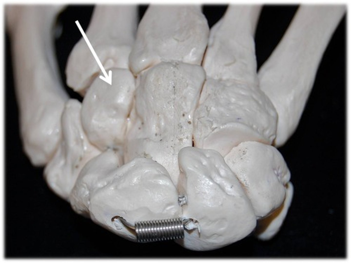 <p>Name this specific bone of the hand (posterior view).</p>