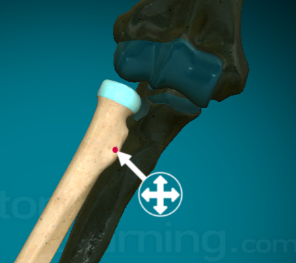 <p>slightly larger, round projection that connects muscles, ligaments, and tendons</p>