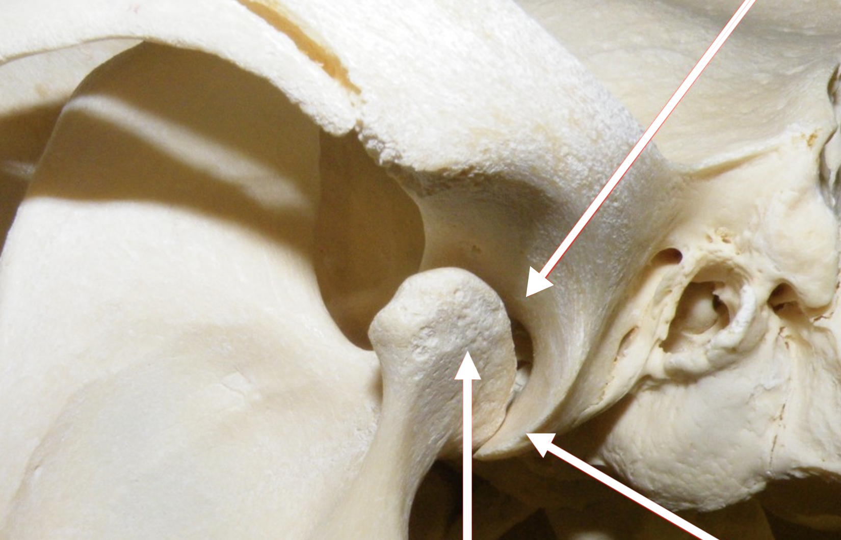 <p>Label the structures that articulate the Temporomandibular joint (TMJ)</p>