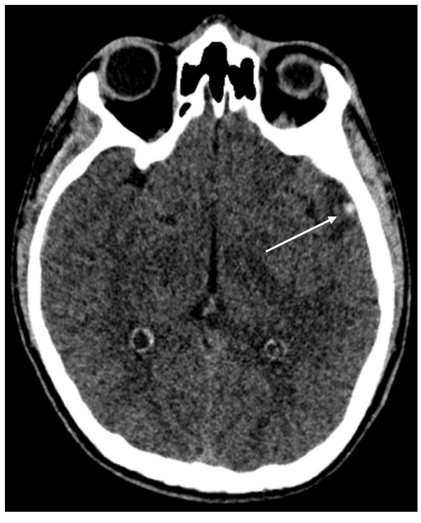 <p>What is shown in this CT image?</p>