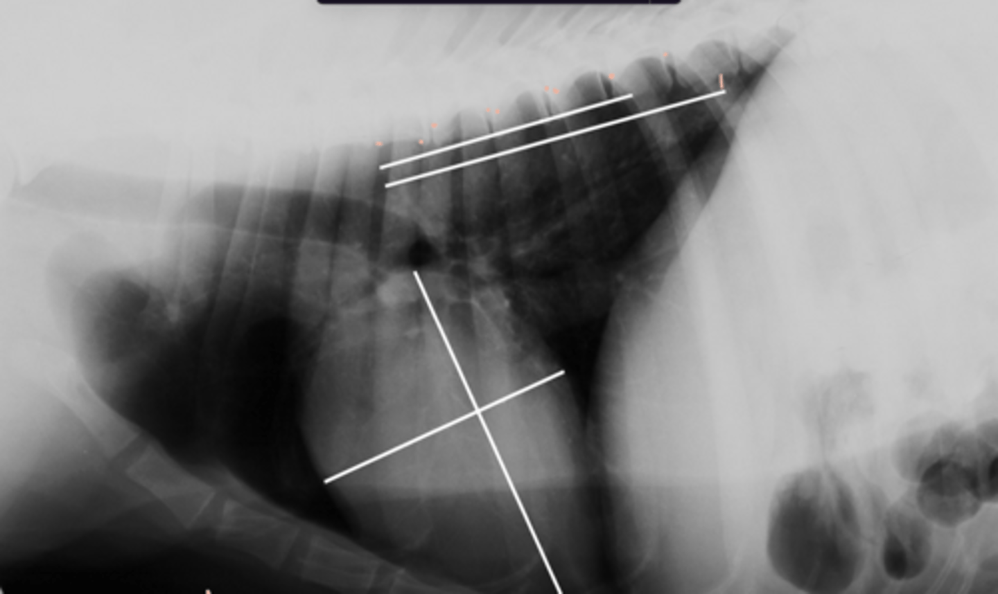 <p>Given the following radiograph do we have an enlarged heart?</p>