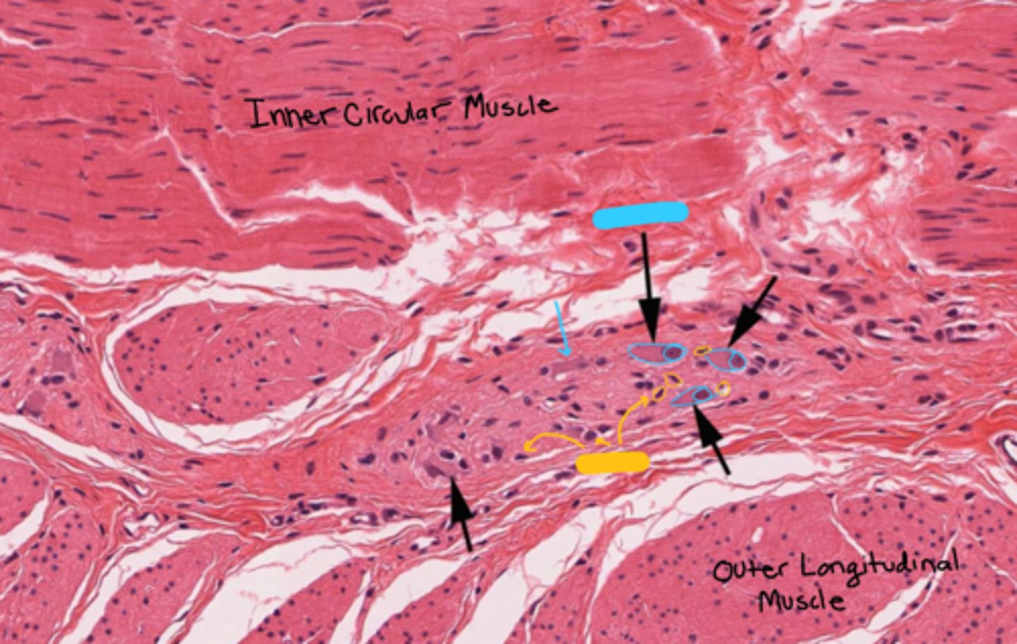 <p>what is this neuronal structure?</p>