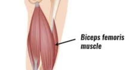 <ul><li><p>hamstring</p></li><li><p>flex knee, extend hip</p></li></ul><p></p>