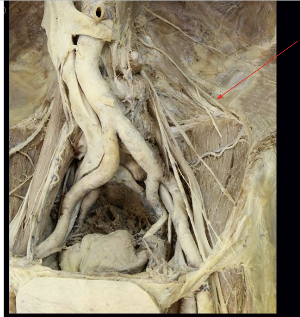 <p>ID Structure and Nerve Root</p>