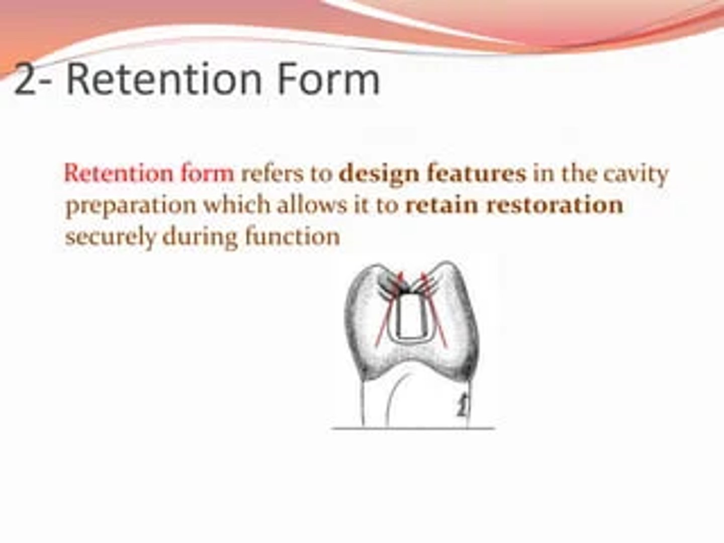 <p>Features of the preparation that prevent the restoration from being displaced or removed by lifting or pulling (tensile) or tipping forces</p><p>Features of the preparation that “retain” the restoration in the tooth</p>